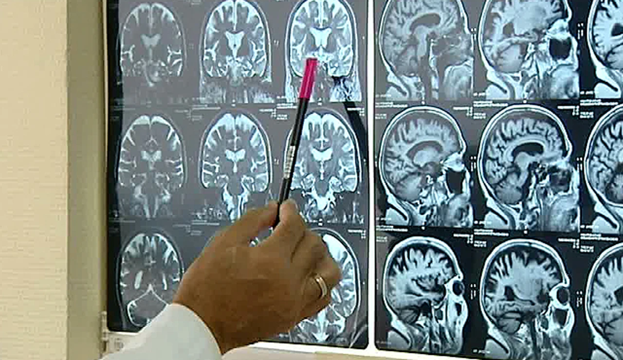 Radiografías del cerebro