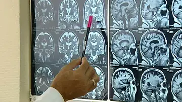 Radiografías del cerebro